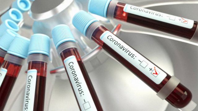  457 defunciones por Coronavirus Panamá,9 fallecen hoy